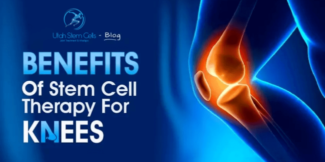 Benefits Of Stem Cell Therapy For Knees