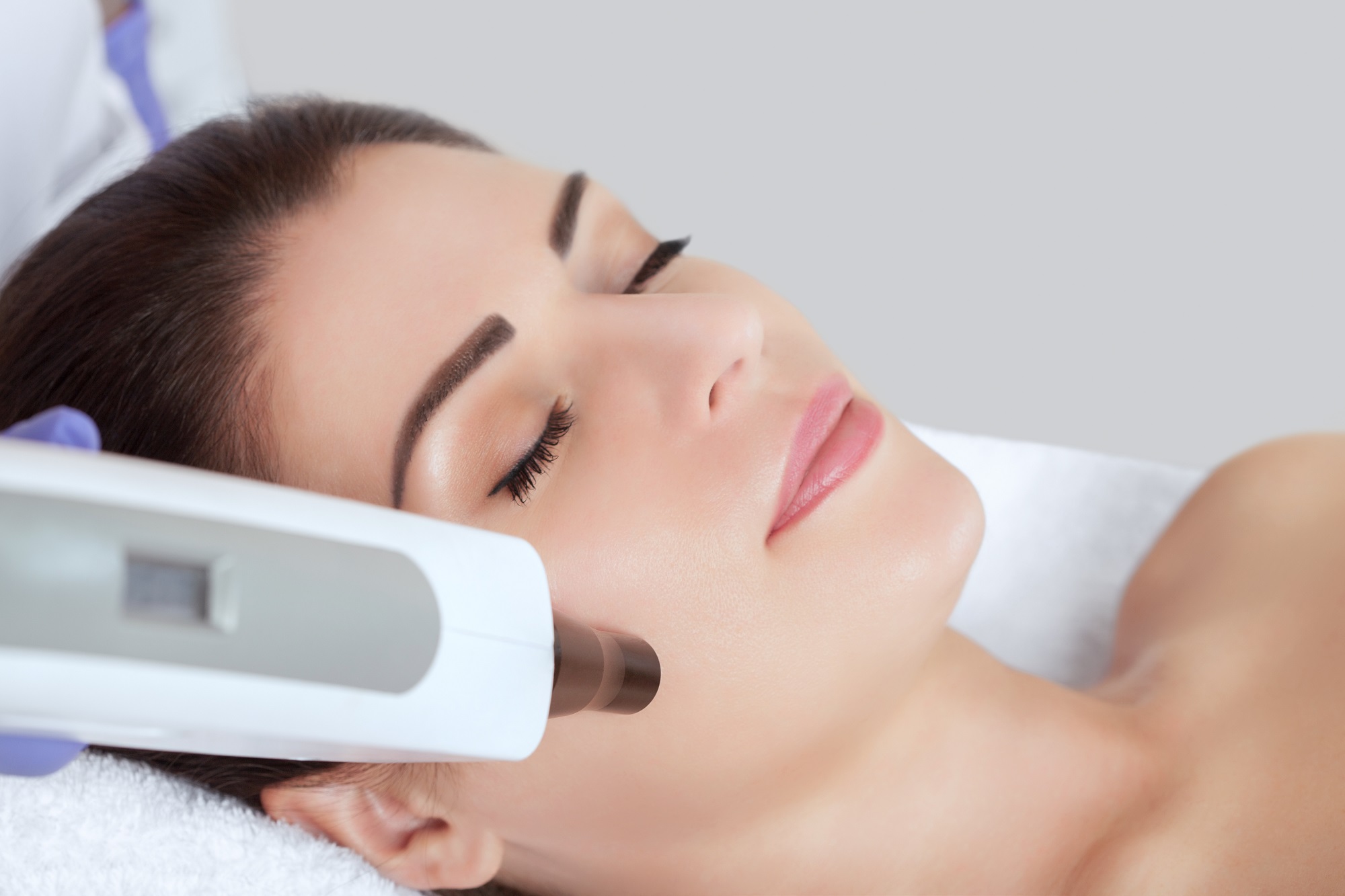 Acne Resurfacing