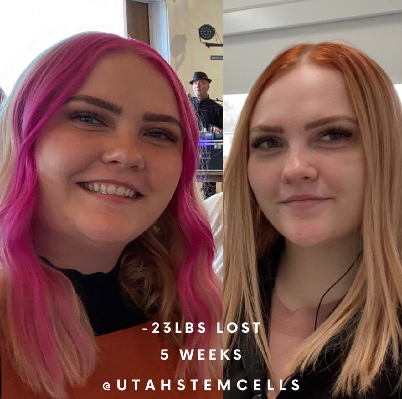 Semaglutide | Utah Stem Cells | Sandy, UT Semaglutide | Utah Stem Cells | Sandy, UT