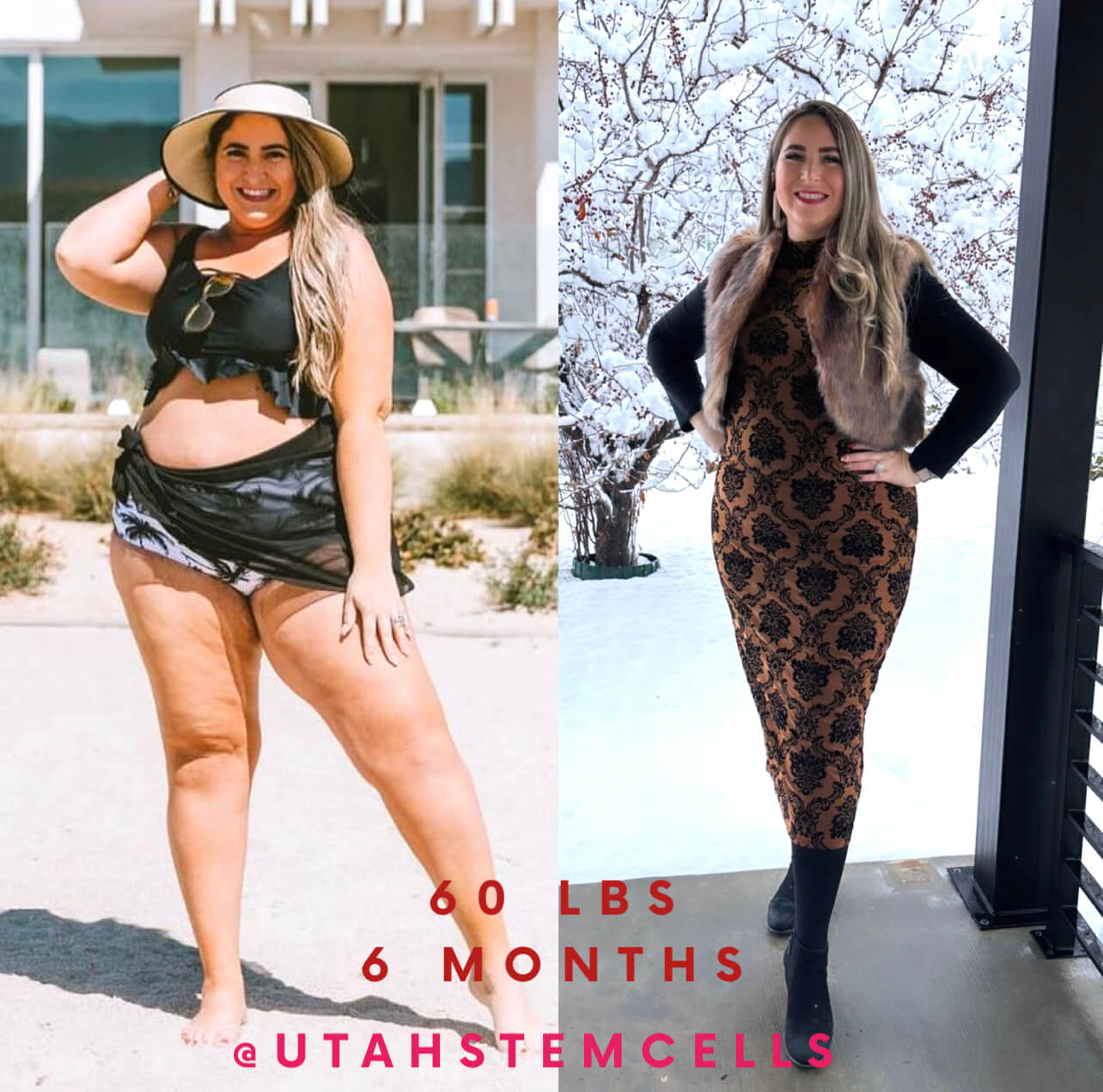 Semaglutide | Utah Stem Cells | Sandy, UT Semaglutide | Utah Stem Cells | Sandy, UT