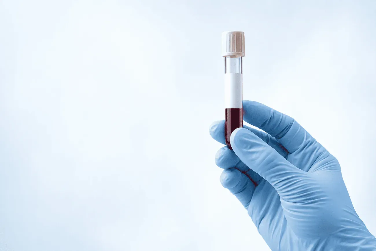 Galleri multi-cancer early detection test in Utah — a blood sample tube held in a gloved hand