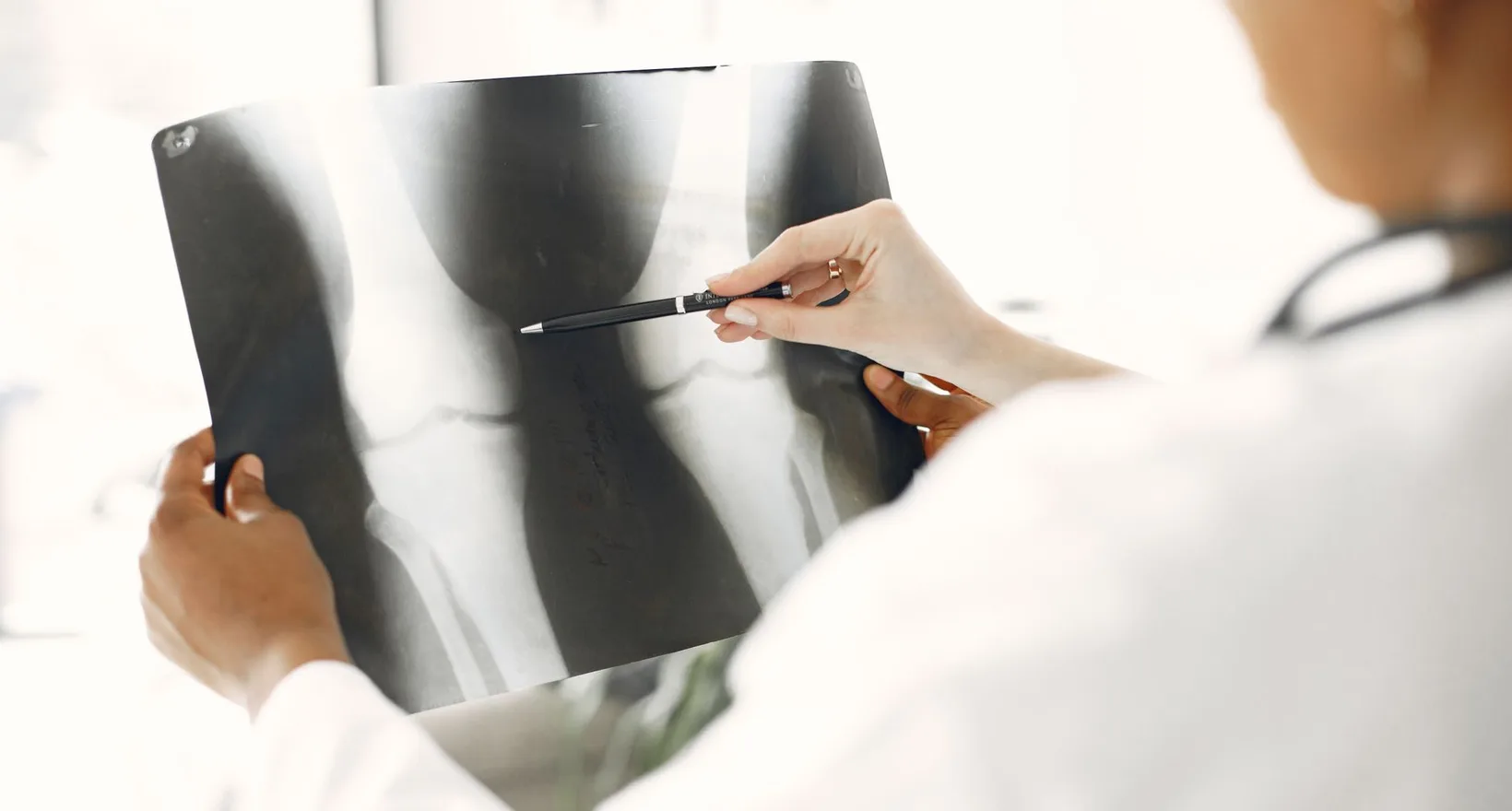 Are You a Good Candidate for Stem Cell Joint Therapy?