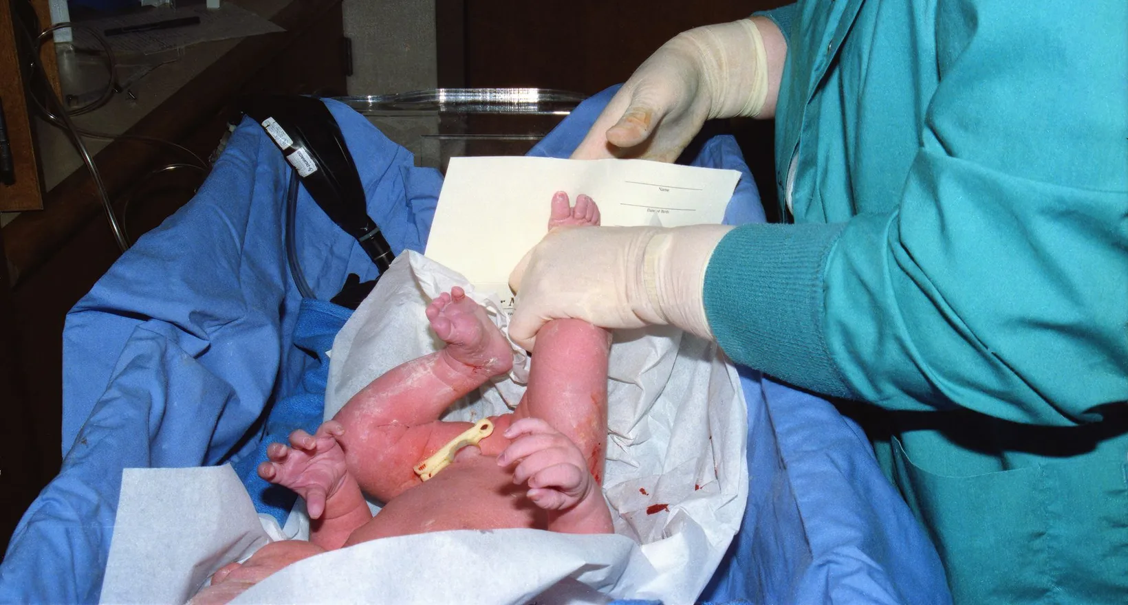 Umbilical Cord Stem Cells: Why Donated Tissue and Not Your Own