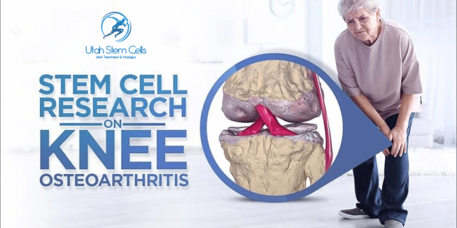 Stem Cell Research on Knee Osteoarthritis