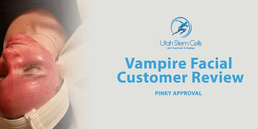 Vampire Facial Customer Review