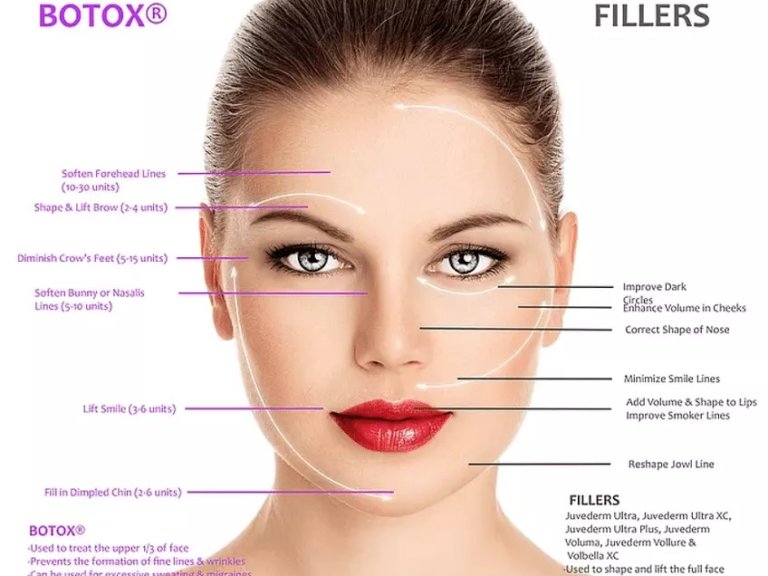 Services | Botox | Dermal Fillers | Xeomin | Dysport Sandy, UT | Utah Stem Cells