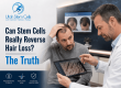 Can Stem Cells Really Reverse Hair Loss? The Truth